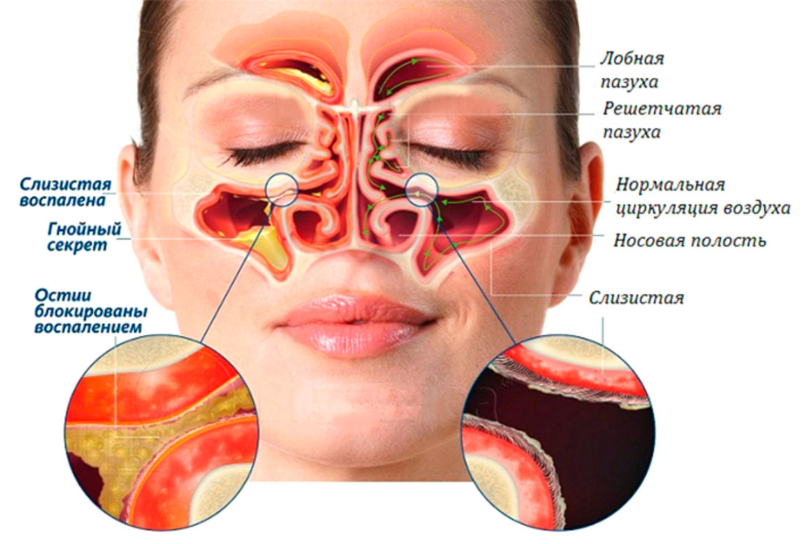 джала-нети как делать